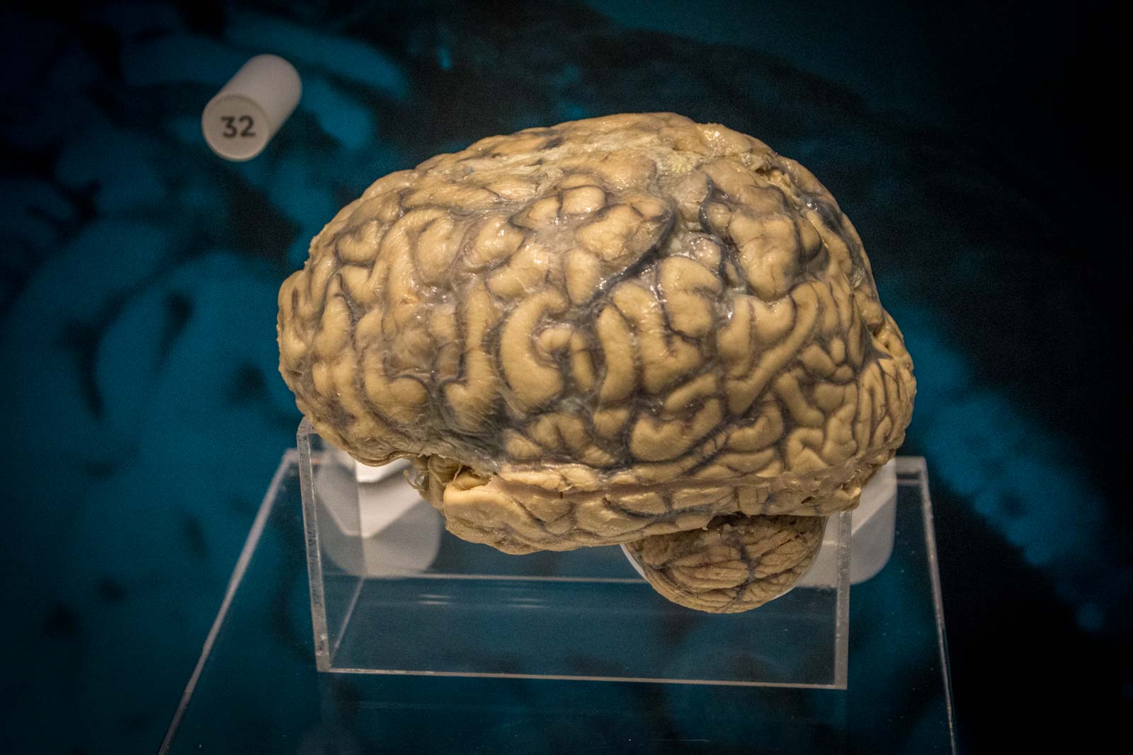 National Museum of Health and Medicine, Silver Springs, Maryland, USA