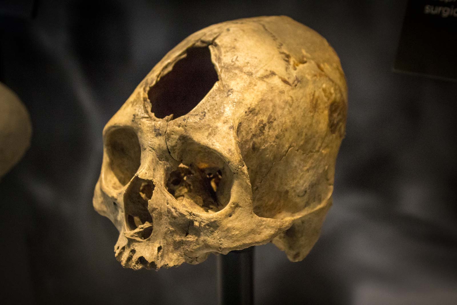 National Museum of Health and Medicine, Silver Springs, Maryland, USA