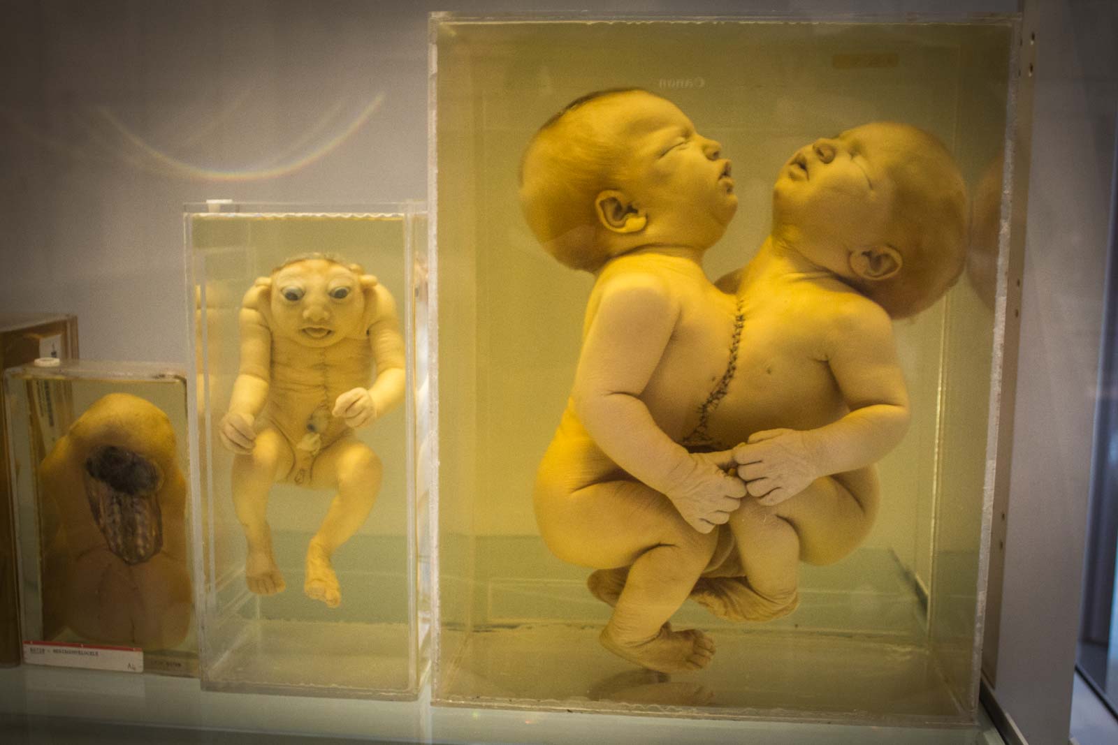 National Museum of Health and Medicine, Silver Springs, Maryland, USA